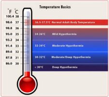 The temperature the human body cannot survive