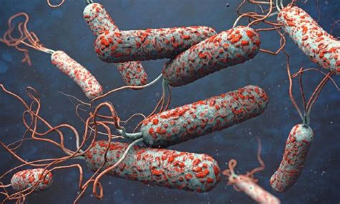 Five districts hit with cholera, 47 cases found nationwide