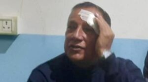 Former Koshi Province Chief Minister Thapa attacked, two apprehended